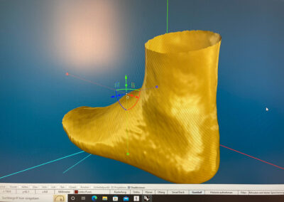 3D Druck in der Orthopädieschuhtechnik