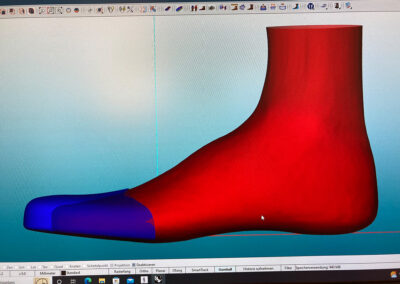 3D Druck in der Orthopädieschuhtechnik