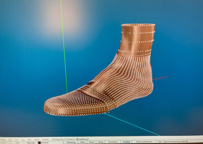 3D Druck in der Orthopädieschuhtechnik