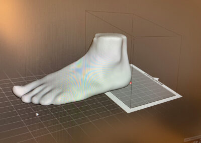 3D Druck in der Orthopädieschuhtechnik