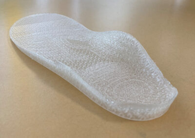 3D Druck in der Orthopädieschuhtechnik